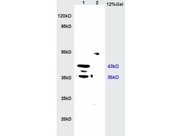 MIIP antibody