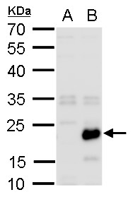 RGS19 antibody