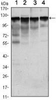 Hexokinase 1 antibody [3A10]
