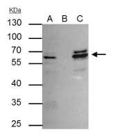 CDR2 antibody