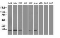 Adenylate kinase 1 antibody [19D1]