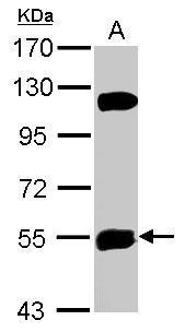 KATNAL1 antibody [C1C3]