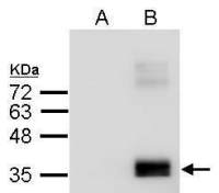 Apolipoprotein E antibody [C2C3], C-term