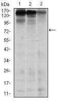 MSH6 antibody [5B11]