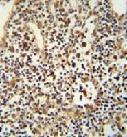 ANO5 antibody, C-term