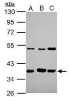 ARA9 antibody [N1C3]