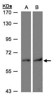 DAK antibody