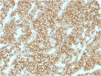 Parathyroid Hormone antibody [PTH/1717R]