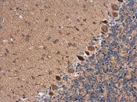 RAB11B antibody [N1C3]