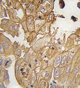 GMFG antibody, N-term