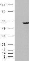 Fumarate hydratase antibody, Internal