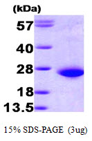 Human RAC1 protein, His tag