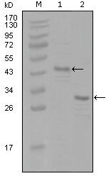 Estrogen Receptor alpha antibody [8H9A10]