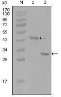 Estrogen Receptor alpha antibody [8H9A10]