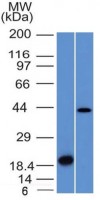 Aurora B antibody [AURKB/1521]