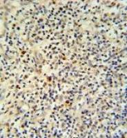 FLI1 antibody, N-term