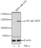 NFkB p100 (phospho Ser870) antibody