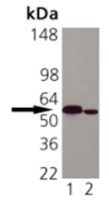 Calreticulin antibody [FMC 75]