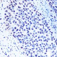 METTL3 antibody