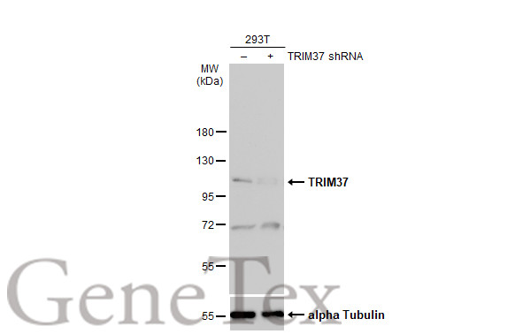 TRIM37 antibody [N1N2], N-term