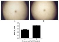 Rat EGF protein, His and GST tag (active)