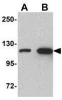 beta Galactosidase antibody