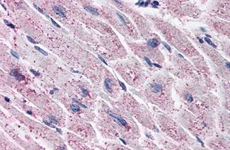 Endothelin A receptor antibody