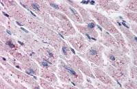 Endothelin A receptor antibody