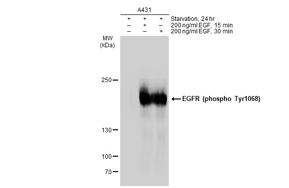 EGFR (phospho Tyr1068) antibody [GT1196]