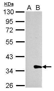 Galectin 8 antibody