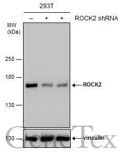 ROCK2 antibody
