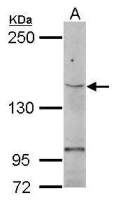 TERT antibody [C2C3-2], C-term