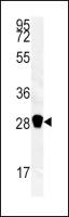 Carbonic Anhydrase III antibody, N-term