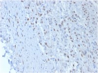 Wilms Tumor 1 antibody [SPM361]