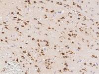Neuroserpin antibody [08]