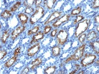 Interferon gamma antibody [IFNG/466]