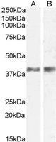 IL12B / IL12 p40 antibody, Internal