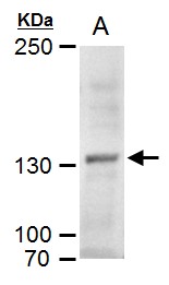 MYT1 antibody