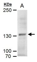 MYT1 antibody