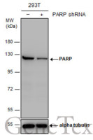 PARP antibody [N2C1], Internal
