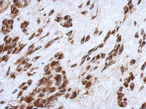 CCDC44 antibody