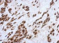 CCDC44 antibody