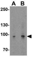 PGC1 alpha antibody
