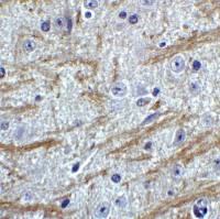 PRDM16 antibody