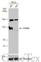 CD146 antibody [N1N3]