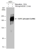 EGFR (phospho Tyr998) antibody