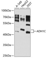 Alcohol dehydrogenase 1C antibody
