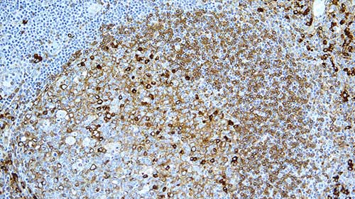 Mouse Anti-Human kappa light chain antibody [CH15]