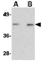 NANOS1 antibody
