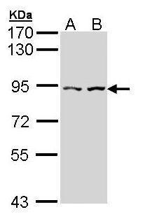 CTNNAL1 antibody [N3C2], Internal